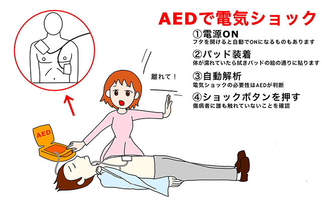 Aedの使い方を知っていますか これを読めば誰かの命を救えるかも 梱包材緩衝材の送料無料激安屋